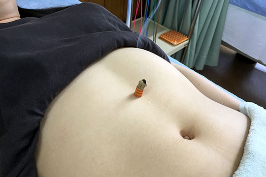 機能性ディスペプシア