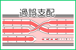 顔面神経麻痺：病的共同運動