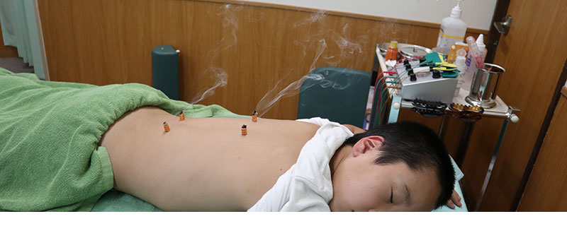 起立性調節障害に対する鍼灸治療